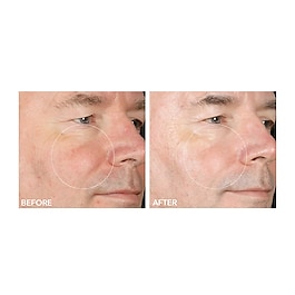 Alpha Beta® - Peel Extra Strength